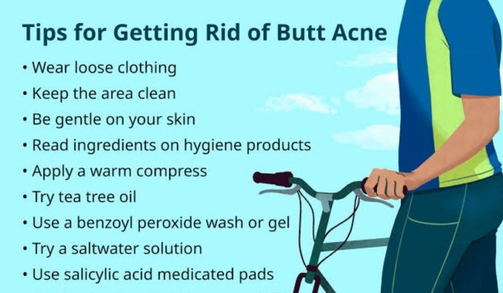 Get Rid of Butt Pimples