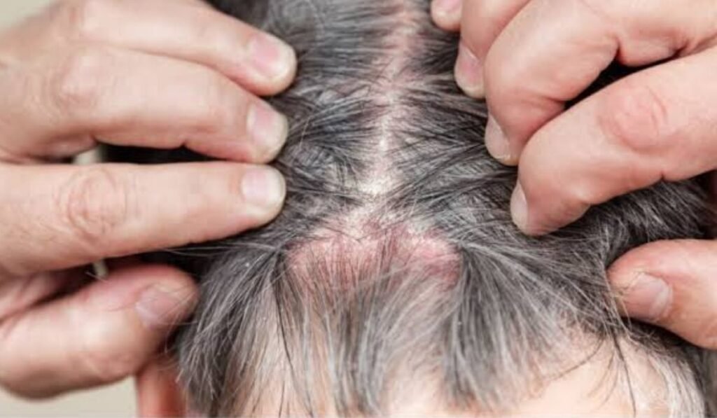 Managing Hair Loss
