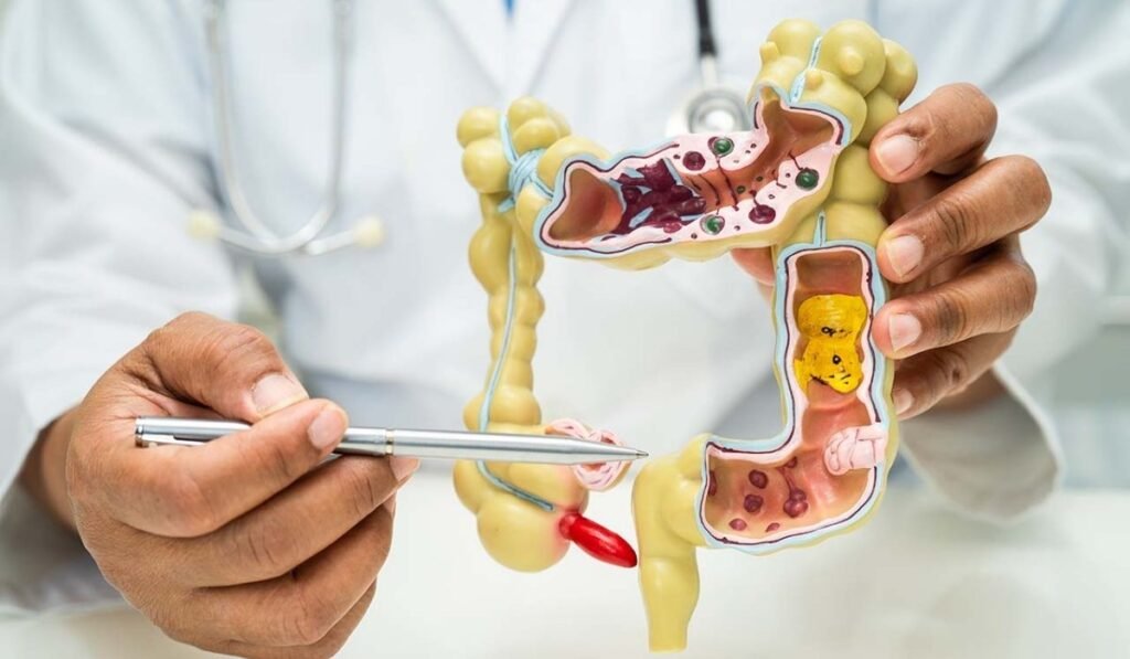 Right Colonoscopy